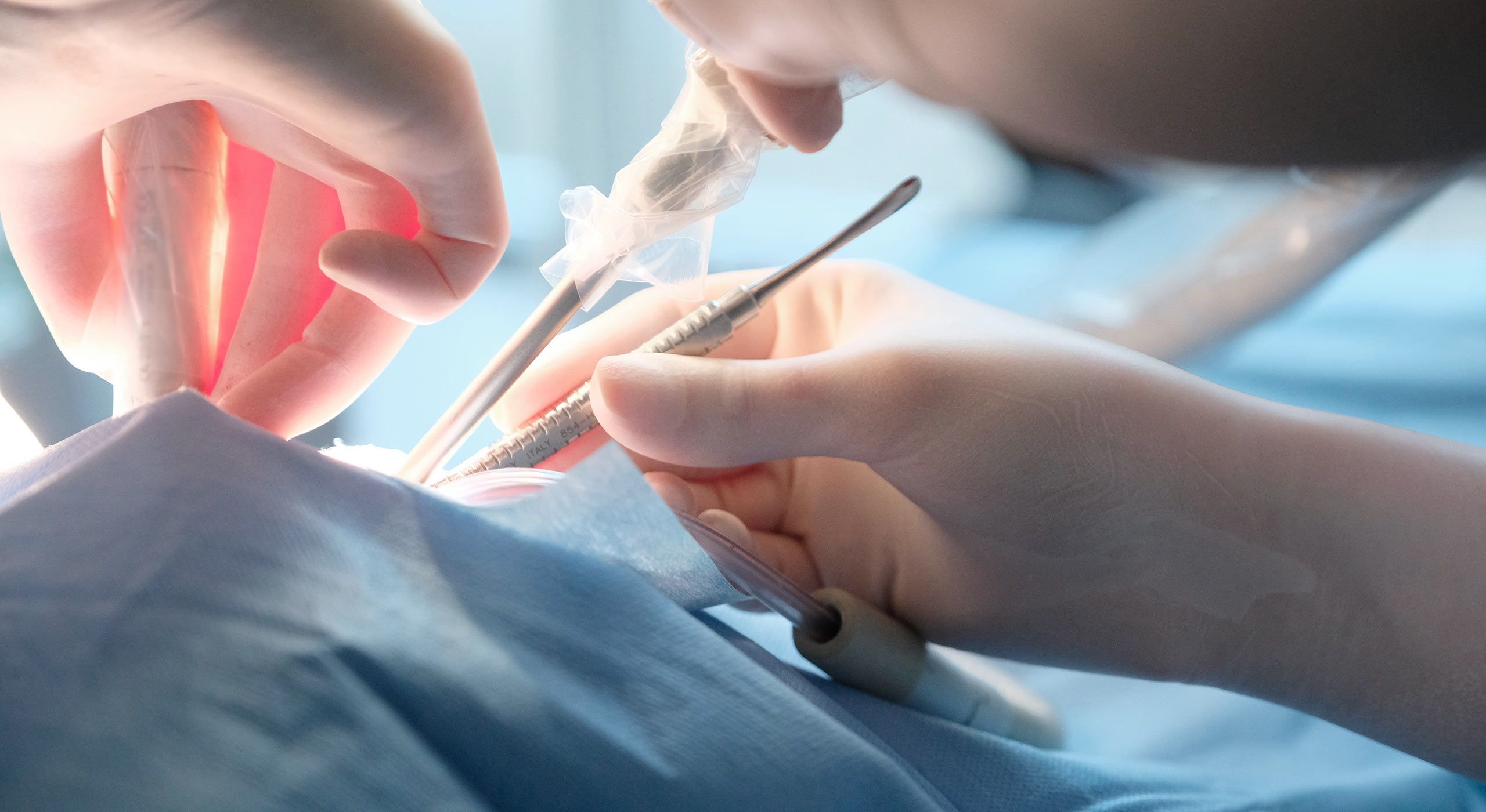 Chirurgie orthodontique à Paris | Dr Cohen